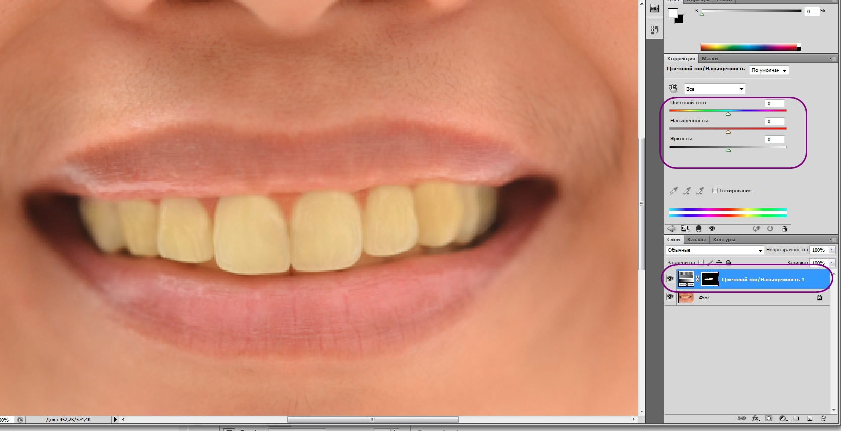 фотошоп зубы отбеливание зубов