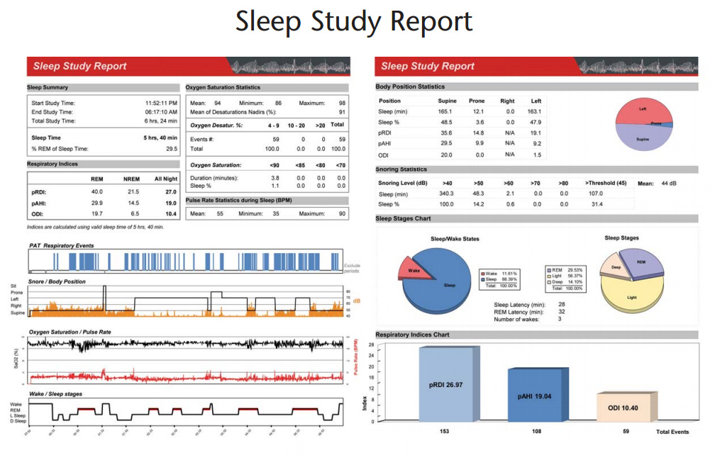 Отчет об исследовании сна